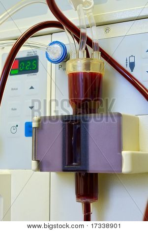 dialyse medische apparatuur