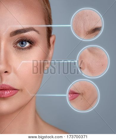 Portrait of woman with zooming detail of skin: damage, acne, wrinkles