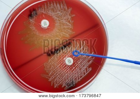 Optochin Subsensitivity Test On Blood Agar Plate Contains Small Light Grains For Streptococcus Pneum
