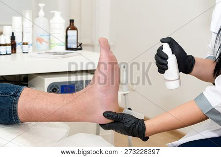 Podology Treatment. Podiatrist Treats Foot. Podiatry Doctor Or Dermatologist Treats The Patient In M