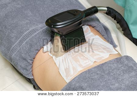 Woman Getting Cryolipolysis Fat Treatment Procedure In Professional Cosmetic Cabinet Or Spa Center