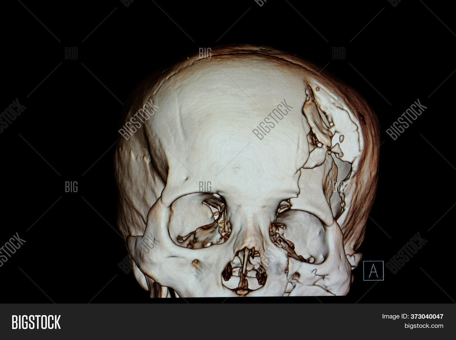 3 D Rendering Image Image Photo Free Trial Bigstock