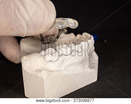 Palatal Expander For The Maxilla, Setting Test. The Removable Orthodontic Appliance To Make The Uppe