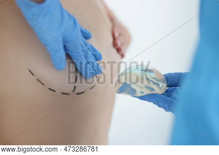 Girl Tries On New Breast With Help Of Silicone Three Dimensional Form. Special Marking Is Made On Gi