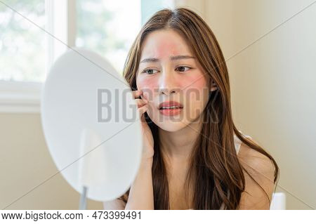 Dermatology, Puberty Asian Young Woman, Girl Looking Into Mirror, Allergy Presenting An Allergic Rea