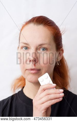 Portrait Of Middle Aged Woman With Herpes Above Upper Lip, On Light Background. Woman Holding Pills 