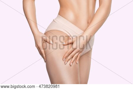 The Girl Stretches The Skin On Her Leg, Showing Fat Deposits And Cellulite. The Concept Of Weight Lo