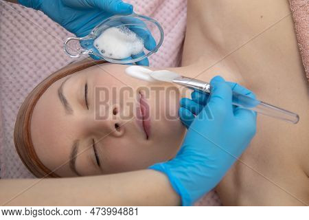 Close Up Cropped Female Patient, Lying On Side, Getting White Benzoyl Peroxide Powder Foam. Acne And