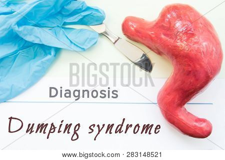 Diagnosis Of Dumping Syndrome. Figure Stomach, Scalpel And Surgical Gloves Lie Near Title Diagnosis 