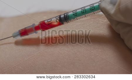 Blood Sampling With Syringe And Needle For Analysis
