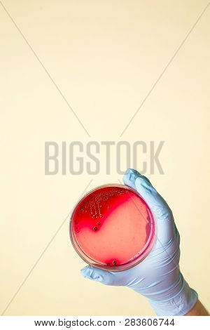 Hand Holds Petri Dish With Staphylococcus Aureus Bacteria. Medical Lab Testing For Infection.bacteri