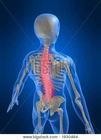 Sırt ağrısı illüstrasyon