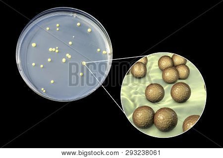 Colonies Of Micrococcus Luteus Bacteria On Agar Plate And Close Up View Of Micrococci Bacteria, Phot