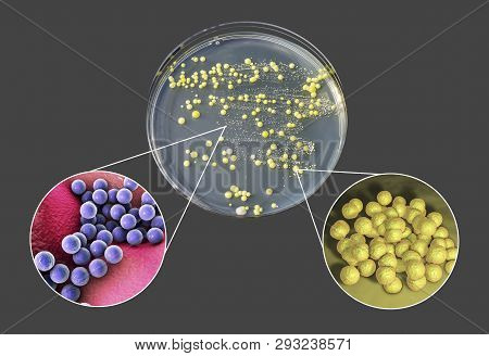 Colonies Of Bacteria Grown From Human Skin Smear, Staphylococcus Epidermidis, Left, And Micrococcus 