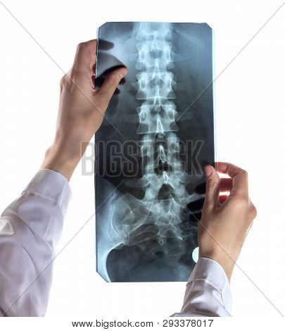 Spine X-ray In The Female Doctor Hands. Isolated On White Background
