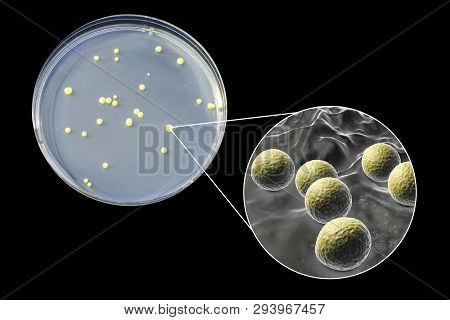 Colonies Of Micrococcus Luteus Bacteria On Agar Plate And Close Up View Of Micrococci Bacteria, Phot