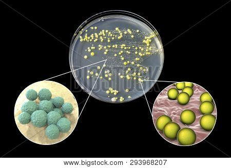 Colonies Of Bacteria Grown From Human Skin Smear, Staphylococcus Epidermidis, Left, And Micrococcus 