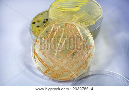 Colonies Of Different Bacteria And Molds