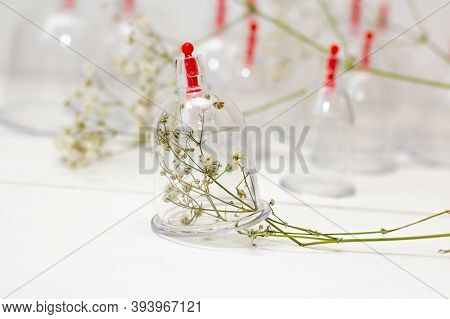 Jars For Hijama On A White Wooden Background And White Flowers. Bloodletting. Sunnah Treatment. Isla
