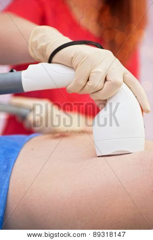 man receiving laser epilation at armpit on beauty center