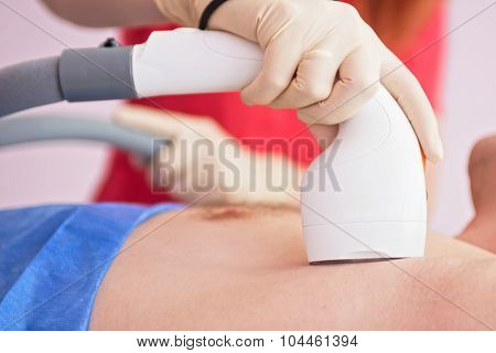 man receiving laser epilation at armpit on beauty center