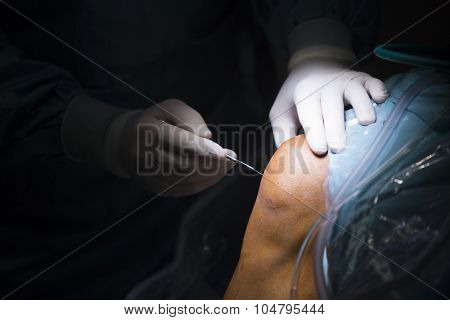 Traumatology Orthopedic Surgery Knee Arthroscopy
