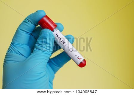 Typhoid blood sample