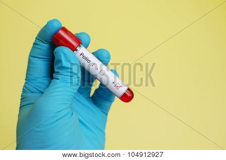 Polio virus positive