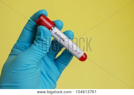 Anthrax blood sample
