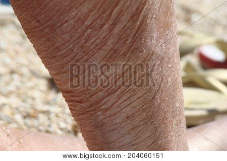 human aging sagging and aged skin of the human body