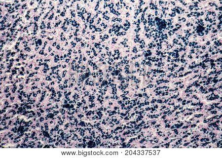 micrographic shot showing the cross section of a human liver