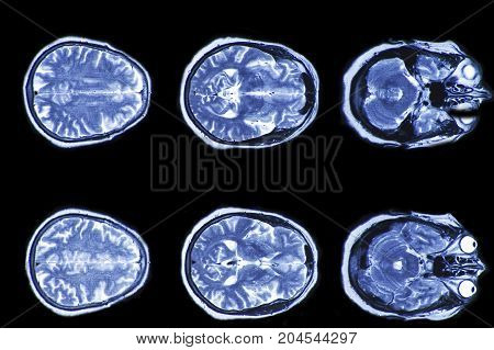 X-ray image of the brain computed tomography, imaging of the brain