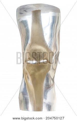 X-Ray Phantom knee transparent isolated on white background