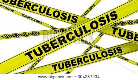 Tuberculosis. Yellow Warning Tapes With Black Words Tuberculosis (is An Infectious Disease Usually C