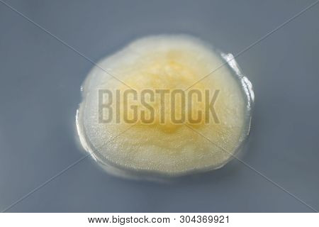 Colony Of Mold Fungus Cultivated From Indoor Air On Petri Dish With Sabourad Dextrose Agar