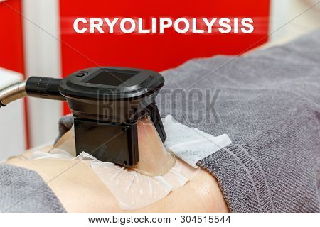 Cryolipolysis Freeze Fat Procedure In Cosmetic Cabinet Or Spa Salon, Belly Close-up