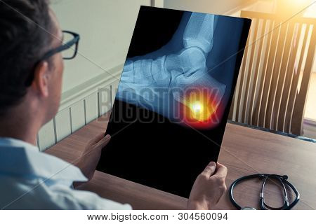 Doctor Holding A X-ray Of Foot And Pain On The Heel In Office
