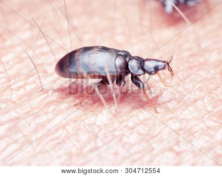 3d rendered illustration of a bed bug