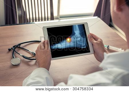 Doctor Holding A Digital Tablet With X-ray Of Foot With Pain On The Top
