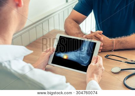 Doctor Holding A Digital Tablet With X-ray Of Foot Of The Patient With Pain Under The Foot