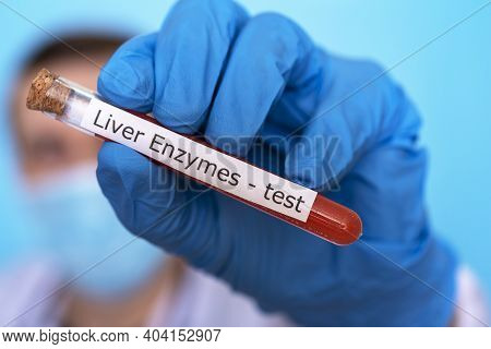 A Hand In A Medical Glove Holds A Flask For A Test For Liver Enzymes.