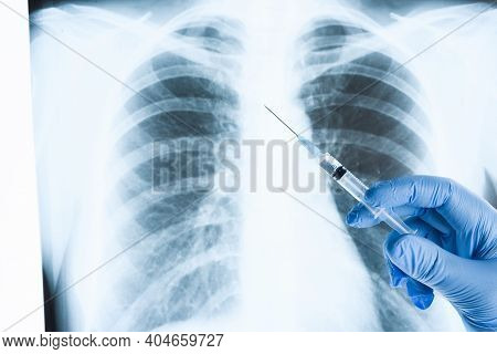 Vaccine Against The Virus. Doctors Hand Holding A Syringe With Medicine On The Background Of A Fluor