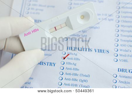 Anti-HBs positive