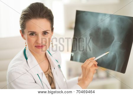 Portrait Of Doctor Woman Pointing On Fluorography