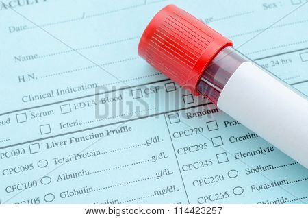 Blood Tube For Test.