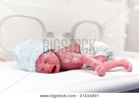 เด็กทารกทารกใน vernix ในการบ่มเพาะวิสาหกิจ