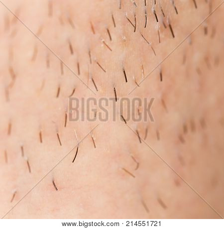 bristles on the skin. close-up . Photo of an abstract texture
