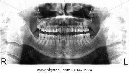 Radiografía dental