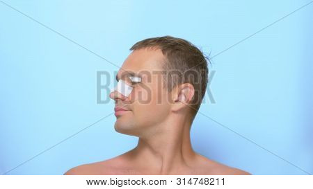 The Concept Of Plastic Surgery, A Man After A Plastic Surgery On The Face, Rhinoplasty And Blepharop