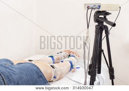 Rheogram Of The Lower Extremities. Patients Legs On Rheovasography. Silver-plated Electrodes Are Con